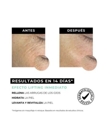 Elixir - Contorno de ojos